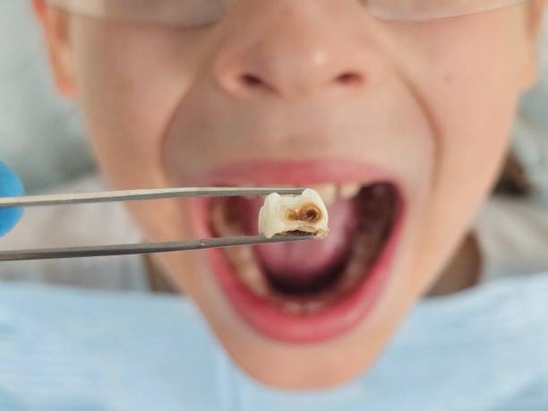 Best Mobile Emergency Dentist in Clarence Center, NY